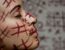 6 sinais que podem indicar automutilação em adolescentes e jovens