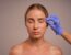 A cirurgia que não aparece redefine o padrão da estética facial